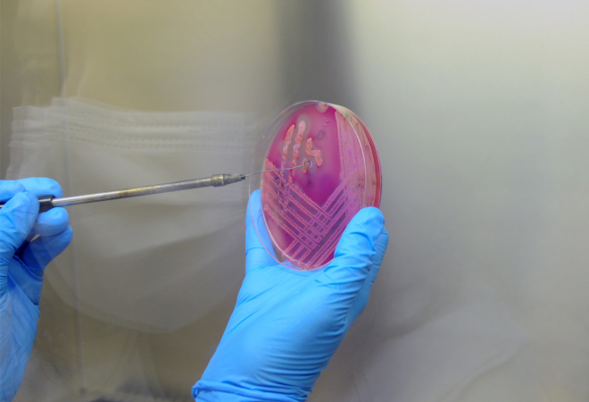 Manos sujetando una placa de Petri en un laboratorio