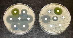 Dos placas de petri con microorganismos